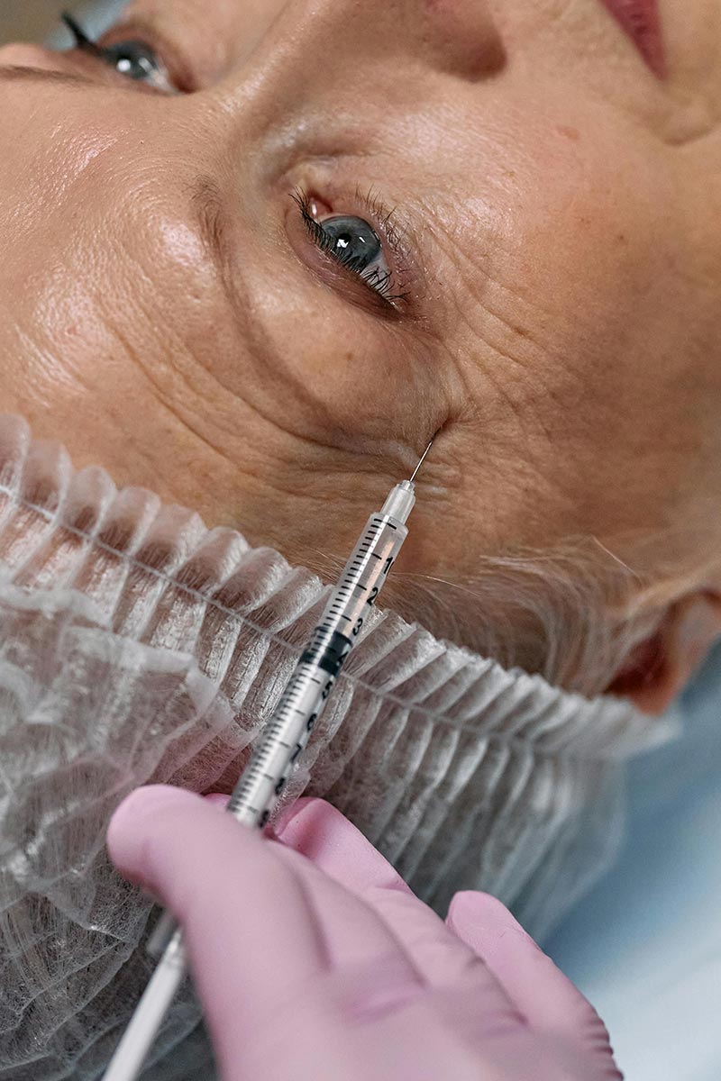 estomper les rides injection botox Angers