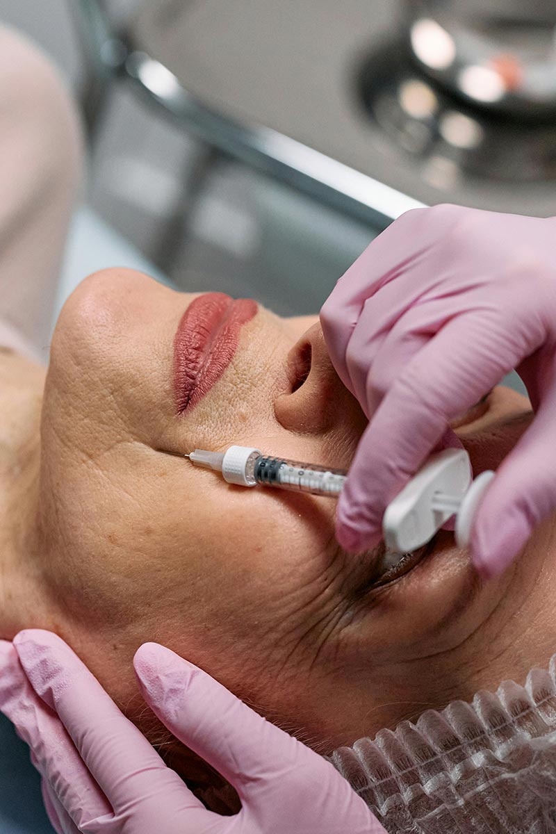 estomper les rides injections d'acide hyaluronique Angers