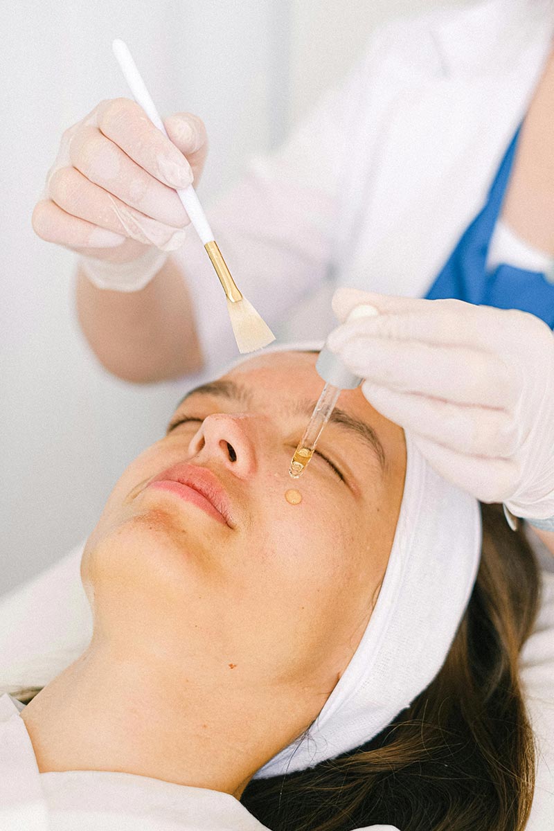 Traitement cicatrices Angers peeling PRX T33 Traitement cicatrices Angers peeling PRX T33