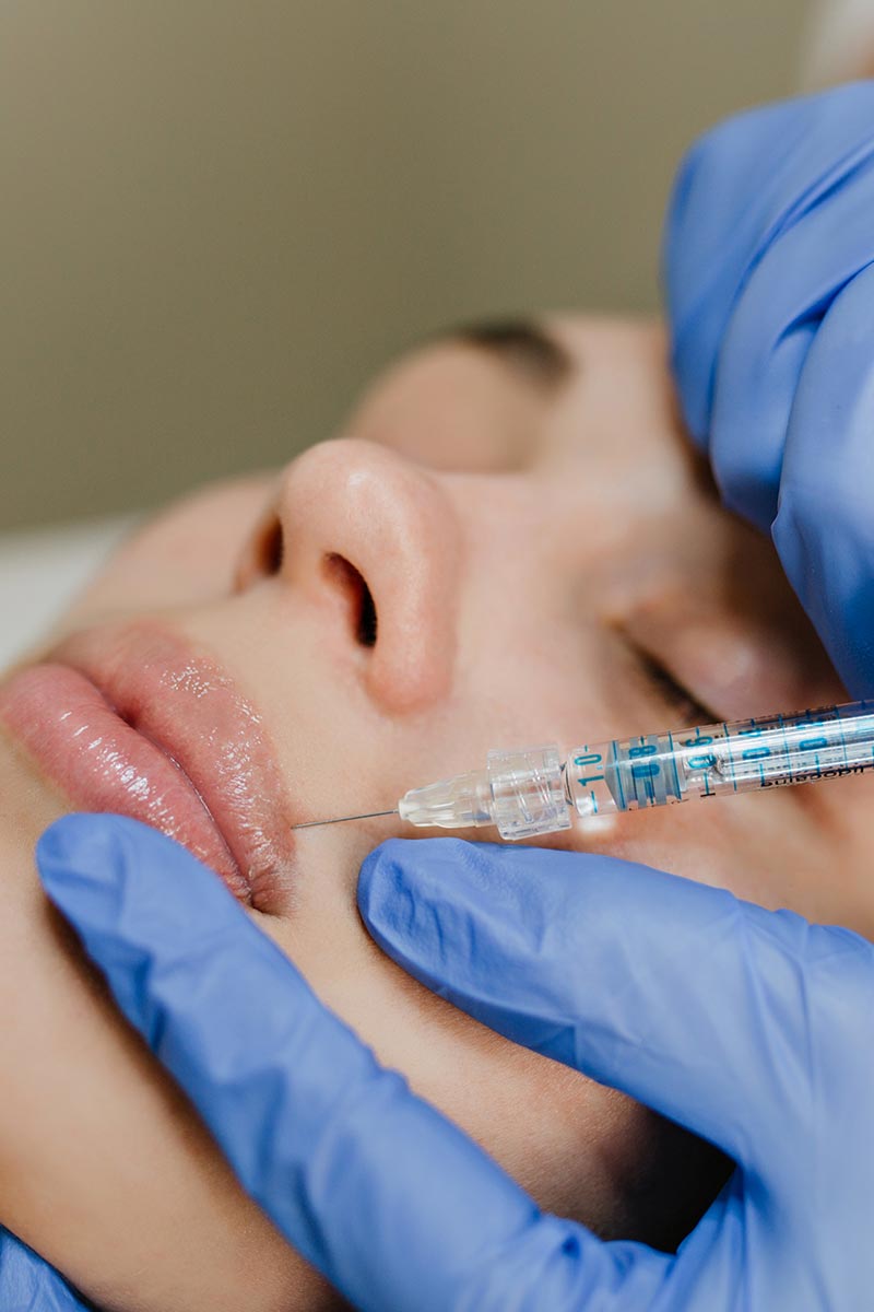 injection acide hyaluronique levres bouche Angers