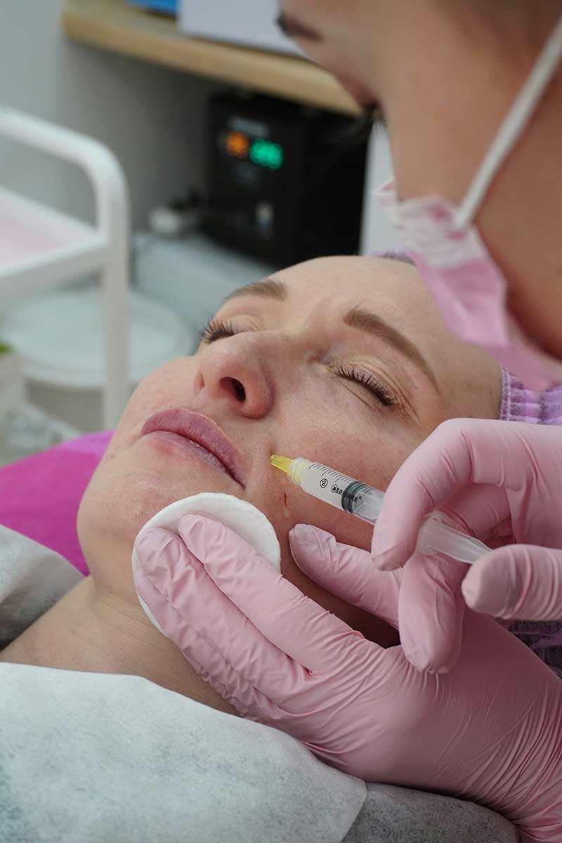 estomper les rides injection botox Angers - injection acide hyaluronique Angers