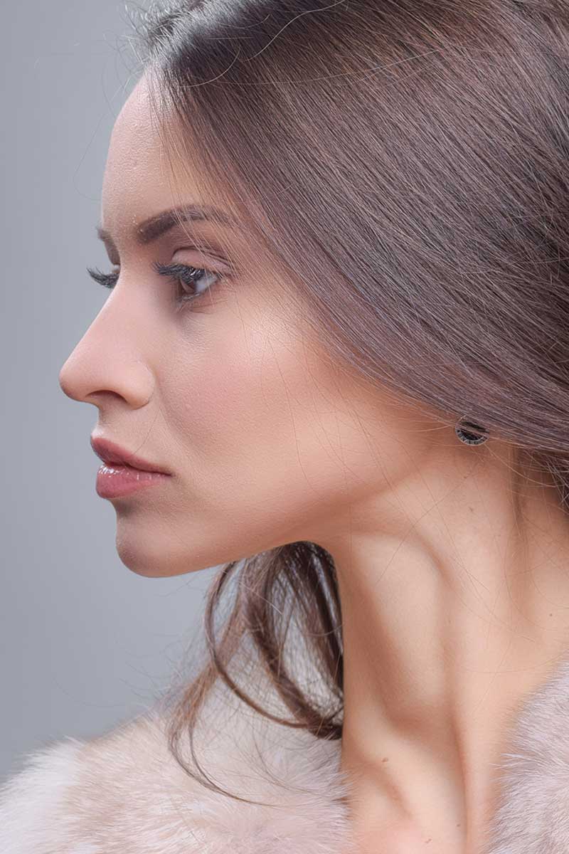 Génioplastie et Profiloplastie Angers