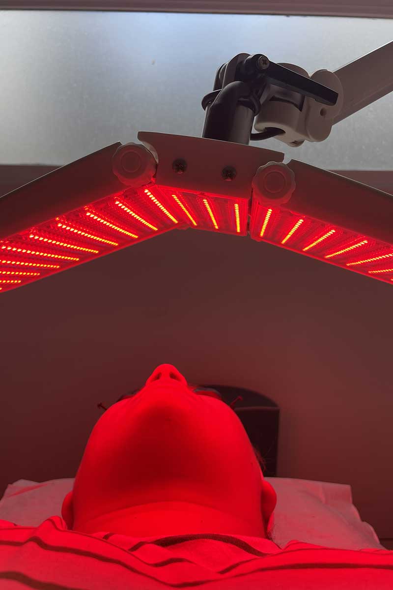 Traitement cicatrices LEDS Angers Traitement cicatrices LEDS Angers